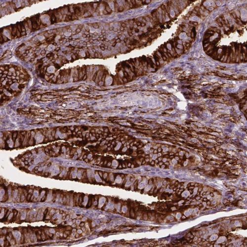 Immunohistochemistry (Formalin/PFA-fixed paraffin-embedded sections) - Anti-TM6SF2 antibody (AB244532)