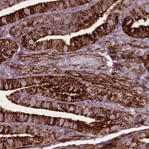 Immunohistochemistry (Formalin/PFA-fixed paraffin-embedded sections) - Anti-TM6SF2 antibody (AB244532)