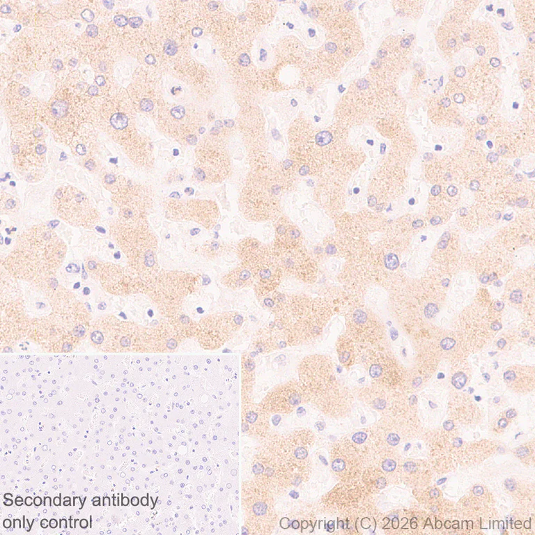 Immunohistochemistry (Formalin/PFA-fixed paraffin-embedded sections) - Anti-TM6SF2 antibody [EPR30567-58] (AB325553)