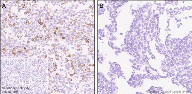 Immunohistochemistry (Formalin/PFA-fixed paraffin-embedded sections) - Anti-TM6SF2 antibody [EPR30567-58] (AB325553)