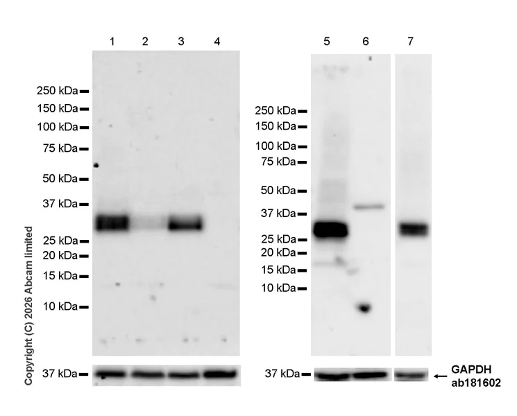 Western blot - Anti-TM6SF2 antibody [EPR30567-58] (AB325553)