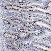 Immunohistochemistry (Formalin/PFA-fixed paraffin-embedded sections) - Anti-Tm9sf3 antibody (AB122562)