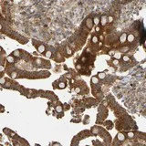 Immunohistochemistry (Formalin/PFA-fixed paraffin-embedded sections) - Anti-TMBIM1 antibody (AB121358)