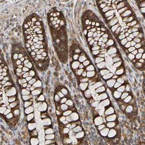 Immunohistochemistry (Formalin/PFA-fixed paraffin-embedded sections) - Anti-TMBIM1 antibody (AB121358), expandable thumbnail