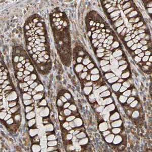 Immunohistochemistry (Formalin/PFA-fixed paraffin-embedded sections) - Anti-TMBIM1 antibody (AB121358)