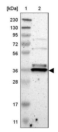 Western blot - Anti-TMBIM1 antibody (AB121358), expandable thumbnail
