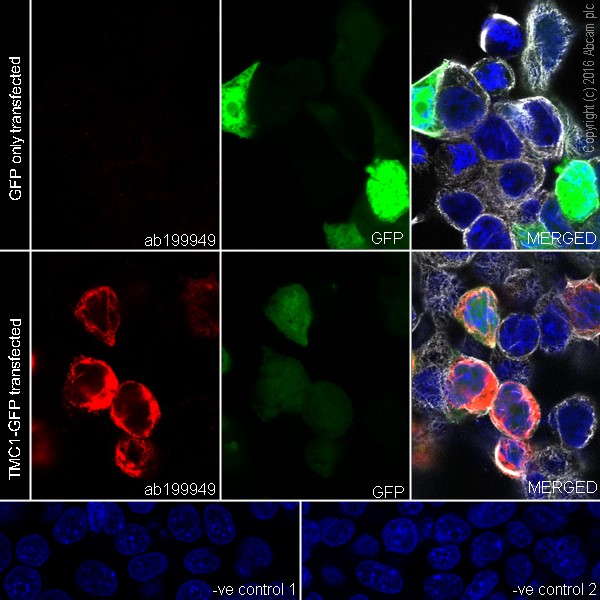 Immunocytochemistry/ Immunofluorescence - Anti-TMC1 antibody [EPR19527] (AB199949), expandable thumbnail