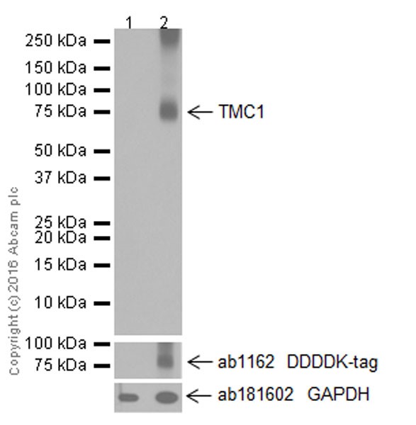 Western blot - Anti-TMC1 antibody [EPR19527] (AB199949), expandable thumbnail
