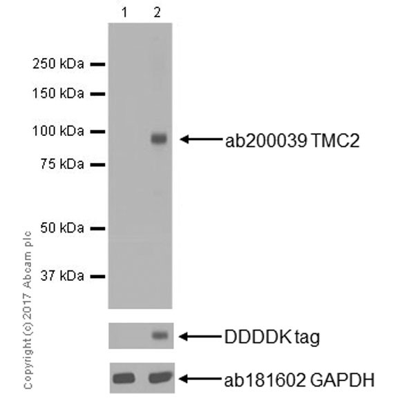Western blot - Anti-TMC2 antibody [EPR19446] (AB200039), expandable thumbnail