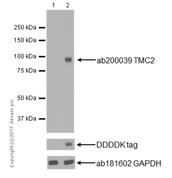 Western blot - Anti-TMC2 antibody [EPR19446] - BSA and Azide free (AB251295)