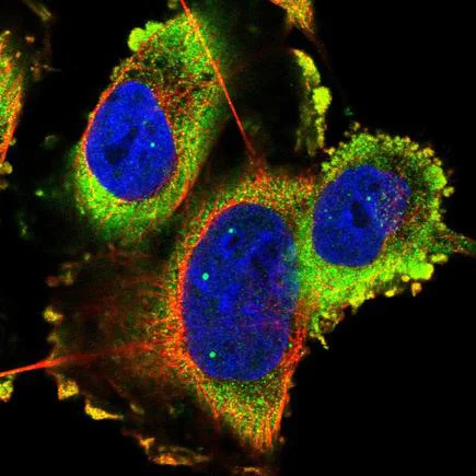 Immunocytochemistry/ Immunofluorescence - Anti-TMC3 antibody (AB243537)