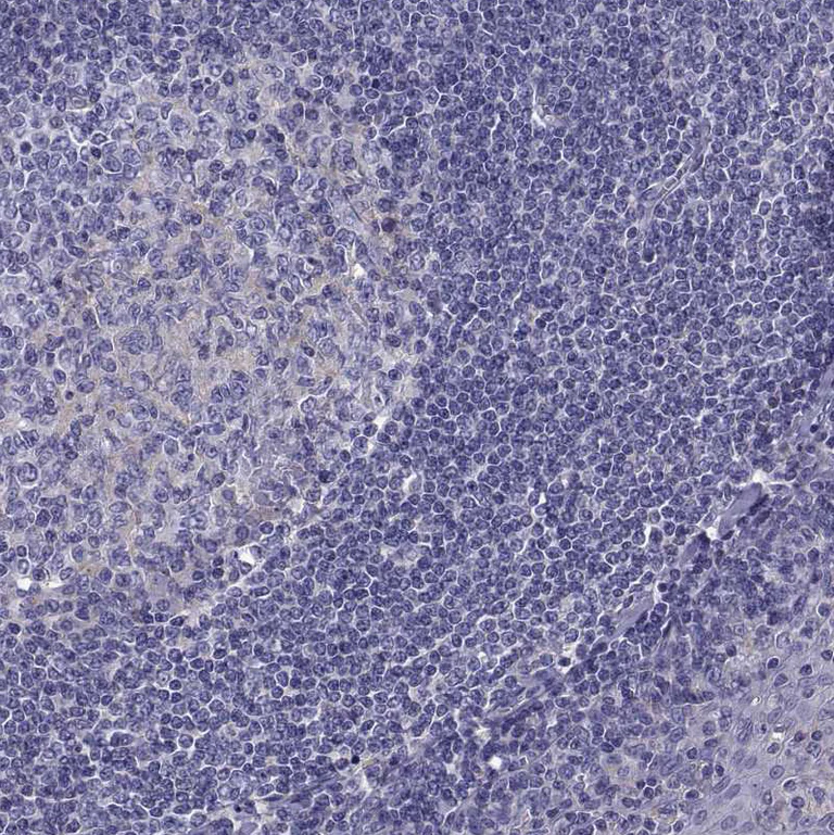 Immunohistochemistry (Formalin/PFA-fixed paraffin-embedded sections) - Anti-TMC3 antibody (AB243537)