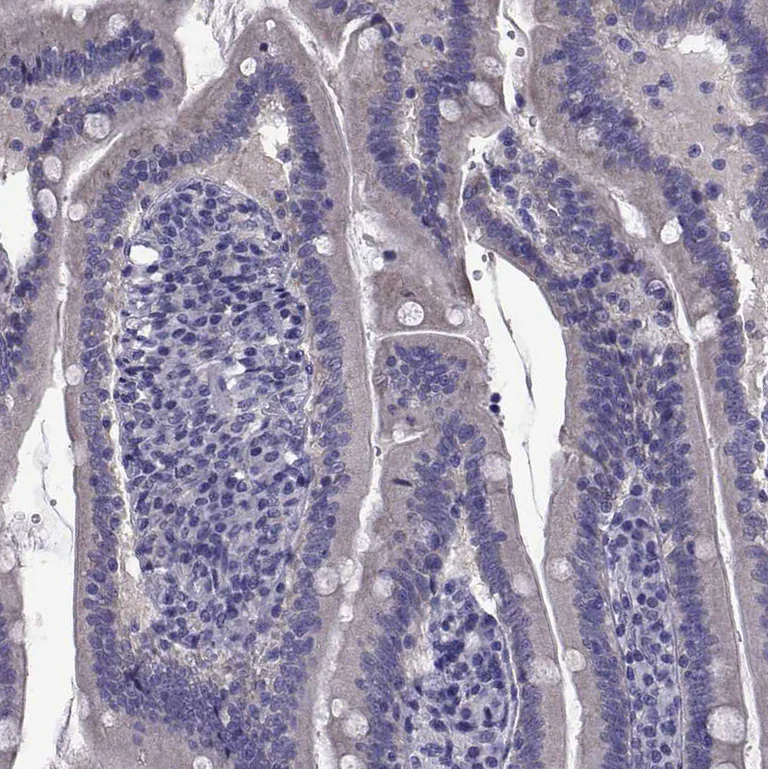 Immunohistochemistry (Formalin/PFA-fixed paraffin-embedded sections) - Anti-TMC3 antibody (AB243537)