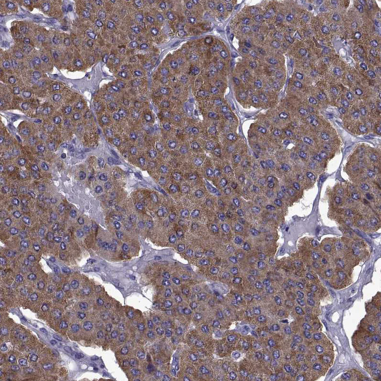Immunohistochemistry (Formalin/PFA-fixed paraffin-embedded sections) - Anti-TMC3 antibody (AB243537)