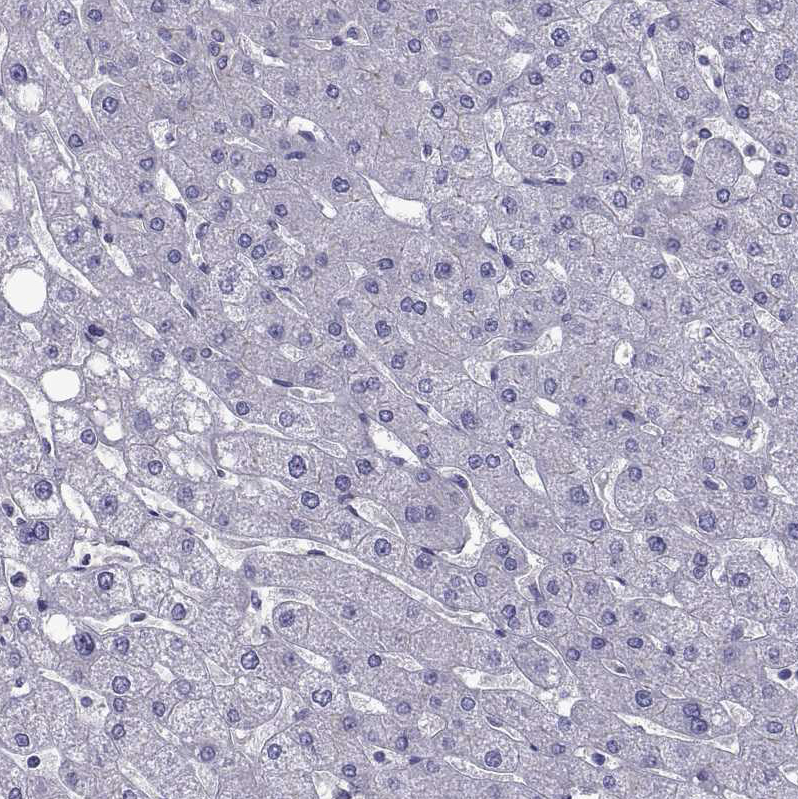 Immunohistochemistry (Formalin/PFA-fixed paraffin-embedded sections) - Anti-TMC3 antibody (AB243537)
