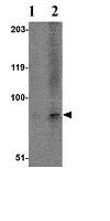 Western blot - Anti-TMC6 antibody (AB67325)