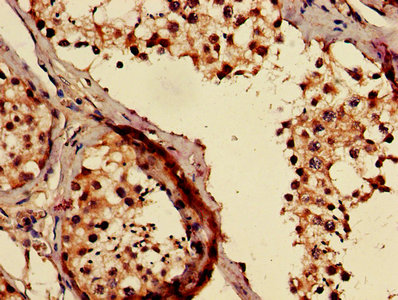 Immunohistochemistry (Formalin/PFA-fixed paraffin-embedded sections) - Anti-TMCO1 antibody (AB238768)