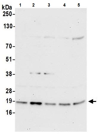 Western blot - Anti-TMED2 antibody (AB241213), expandable thumbnail