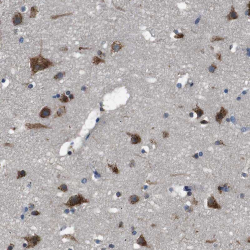 Immunohistochemistry (Formalin/PFA-fixed paraffin-embedded sections) - Anti-TMED2 antibody (AB251705), expandable thumbnail