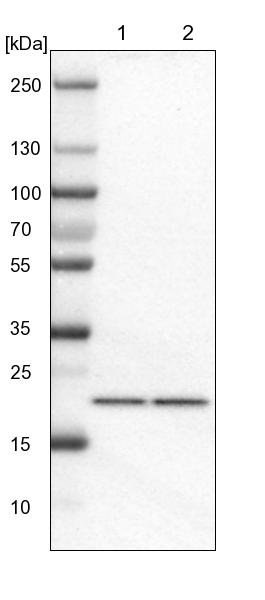 Western blot - Anti-TMED2 antibody (AB251705), expandable thumbnail