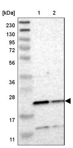 Western blot - Anti-TMED2 antibody (AB251705), expandable thumbnail