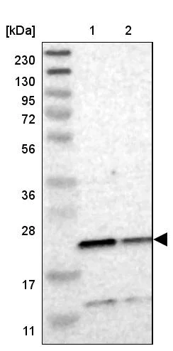 Western blot - Anti-TMED2 antibody (AB251705)