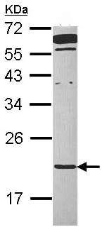 Western blot - Anti-TMED2 antibody (AB97600)