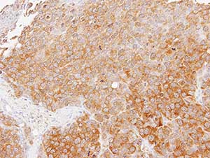 Immunohistochemistry (Formalin/PFA-fixed paraffin-embedded sections) - Anti-TMED4 antibody (AB153814)
