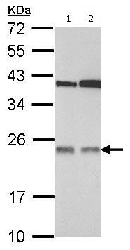 Western blot - Anti-TMED7 antibody (AB126094), expandable thumbnail