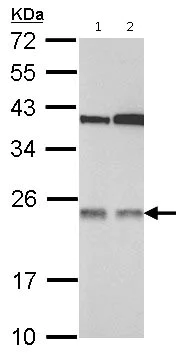 Western blot - Anti-TMED7 antibody (AB126094)