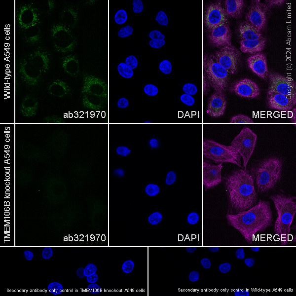 Immunocytochemistry/ Immunofluorescence - Anti-TMEM106B antibody [EPR27525-70] (AB321970), expandable thumbnail