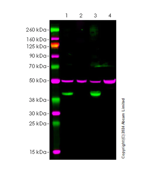 Western blot - Anti-TMEM106B antibody [EPR27525-70] (AB321970)