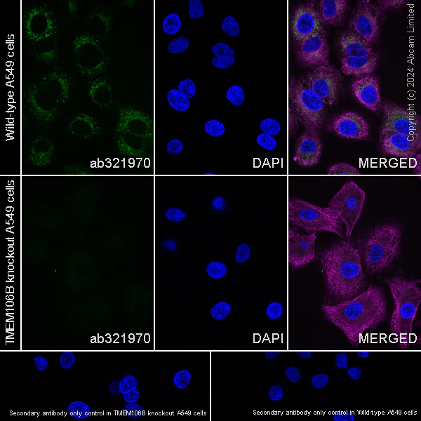 Immunocytochemistry/ Immunofluorescence - Anti-TMEM106B antibody [EPR27525-70] - BSA and Azide free (AB321971)