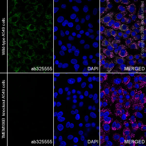 Immunocytochemistry/ Immunofluorescence - Anti-TMEM106B antibody [EPR30569-128] - N-terminal (AB325555)