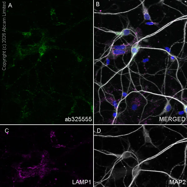 Immunocytochemistry/ Immunofluorescence - Anti-TMEM106B antibody [EPR30569-128] - N-terminal (AB325555)