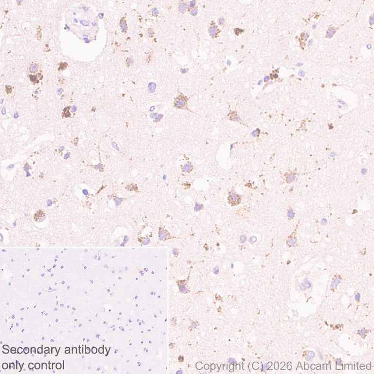 Immunohistochemistry (Formalin/PFA-fixed paraffin-embedded sections) - Anti-TMEM106B antibody [EPR30569-44] - C-terminal (AB325607)