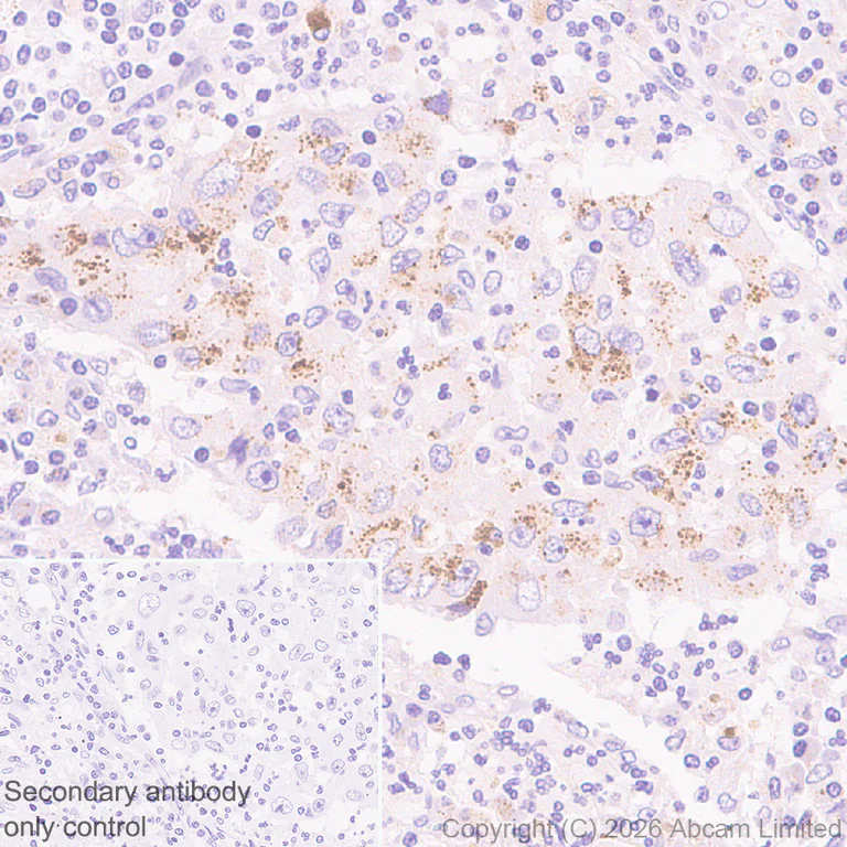 Immunohistochemistry (Formalin/PFA-fixed paraffin-embedded sections) - Anti-TMEM106B antibody [EPR30569-44] - C-terminal (AB325607)