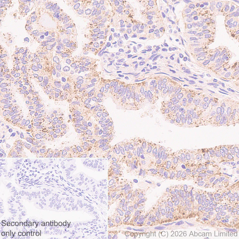 Immunohistochemistry (Formalin/PFA-fixed paraffin-embedded sections) - Anti-TMEM106B antibody [EPR30569-44] - C-terminal (AB325607)