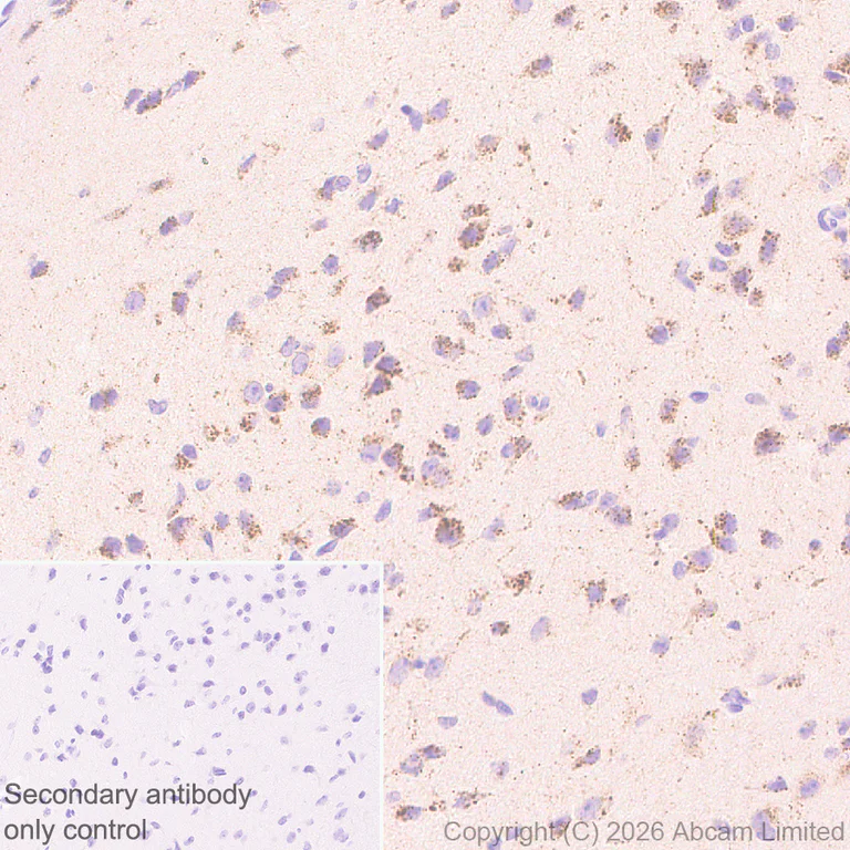 Immunohistochemistry (Formalin/PFA-fixed paraffin-embedded sections) - Anti-TMEM106B antibody [EPR30569-44] - C-terminal (AB325607)