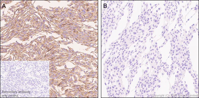 Immunohistochemistry (Formalin/PFA-fixed paraffin-embedded sections) - Anti-TMEM106B antibody [EPR30569-44] - C-terminal (AB325607)