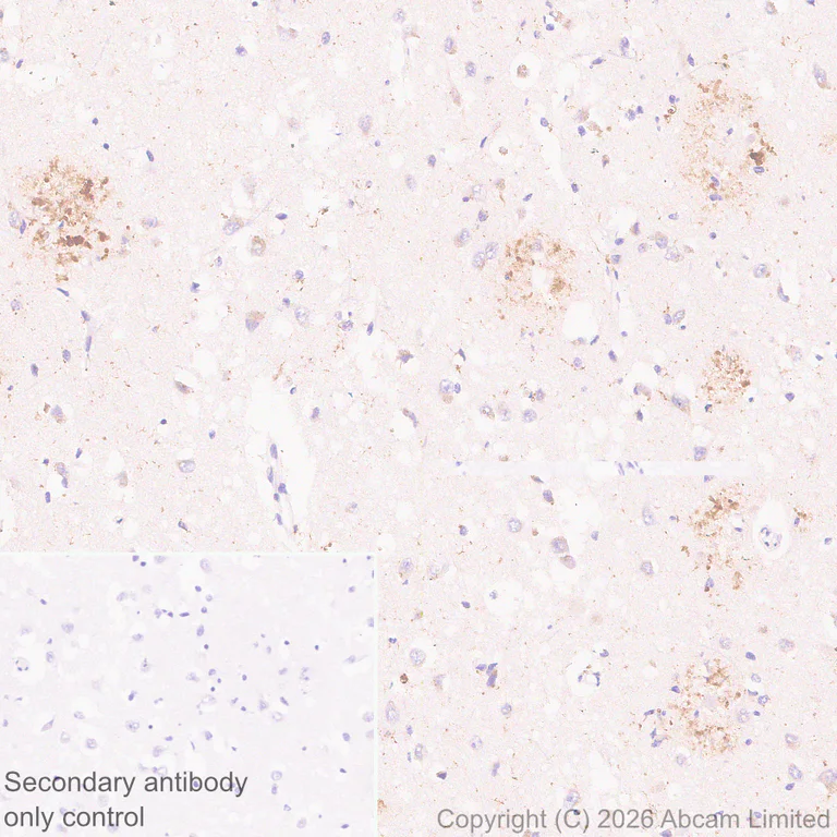 Immunohistochemistry (Formalin/PFA-fixed paraffin-embedded sections) - Anti-TMEM106B antibody [EPR30569-44] - C-terminal (AB325607)