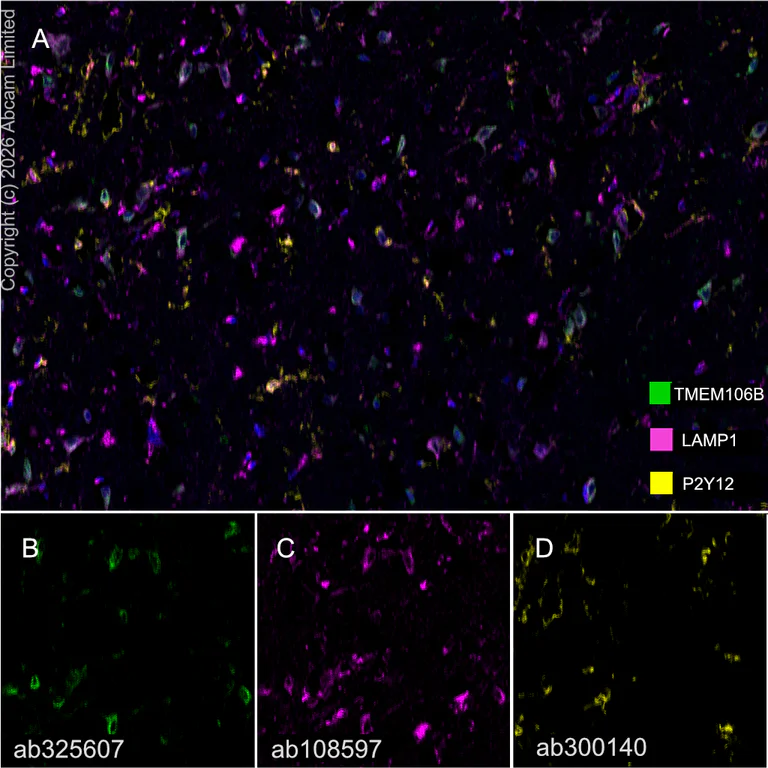 Multiplex immunohistochemistry - Anti-TMEM106B antibody [EPR30569-44] - C-terminal (AB325607)