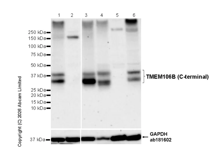 Western blot - Anti-TMEM106B antibody [EPR30569-44] - C-terminal (AB325607)