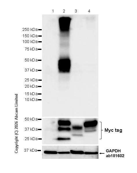 Western blot - Anti-TMEM106B antibody [EPR30569-44] - C-terminal (AB325607)