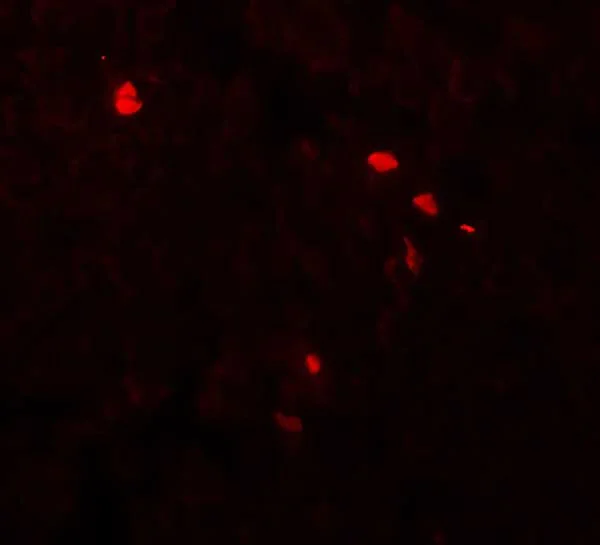 Immunohistochemistry (Formalin/PFA-fixed paraffin-embedded sections) - Anti-TMEM107 antibody - N-terminal (AB181396)