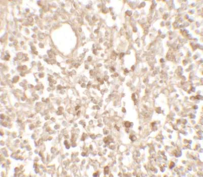 Immunohistochemistry (Formalin/PFA-fixed paraffin-embedded sections) - Anti-TMEM107 antibody - N-terminal (AB181396)