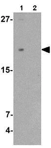 Western blot - Anti-TMEM107 antibody - N-terminal (AB181396)