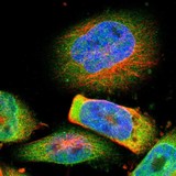 Immunocytochemistry/ Immunofluorescence - Anti-TMEM109/Mitsugumin-23 antibody (AB121349), expandable thumbnail