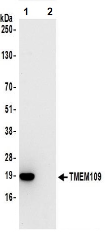 Immunoprecipitation - Anti-TMEM109/Mitsugumin-23 antibody (AB241992)