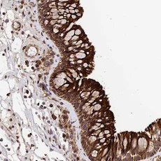 Immunohistochemistry (Formalin/PFA-fixed paraffin-embedded sections) - Anti-TMEM111 antibody (AB122786)